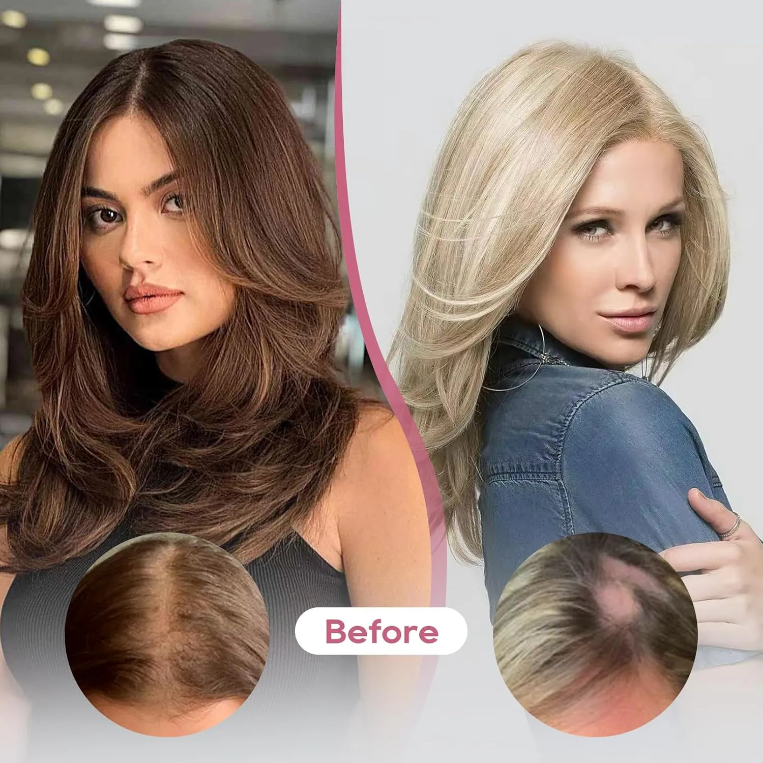 REECHO Real Human Hair Topper, 10 inch Women Hair Toppers for Thinning Hair, 100 Percent Human Hair Large Coverage Natural Hairpiece Wiglet, Waterdrop Base 2.5"x4", Natural Black